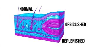 in the dermis and sub-muscular layers