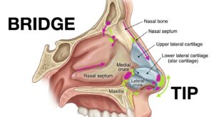 A clinical diagram of nasal anatomy showing structural support vectors for non-surgical contouring.
