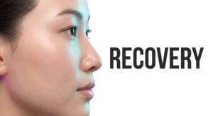 A serene East Asian female model showing healthy skin and the profile of a refined nose after a non-surgical procedure.