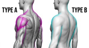 Diagram comparing two types of shoulder contouring approaches