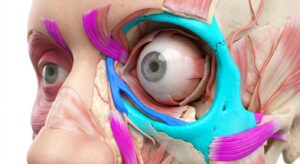 3D illustration of human periorbital anatomy showing the tear trough region and thin skin layers.